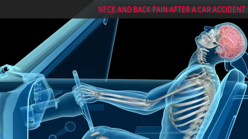 Neck and Back Pain After a Car Accident