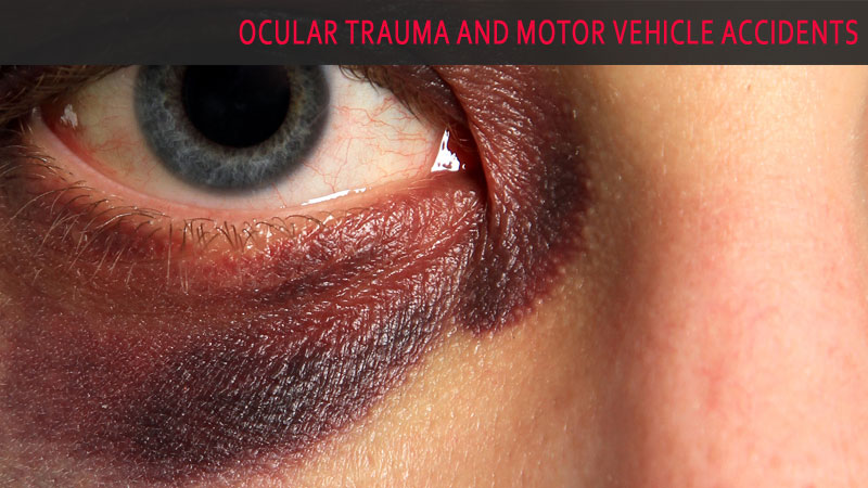 Ocular Trauma and Motor Vehicle Accidents